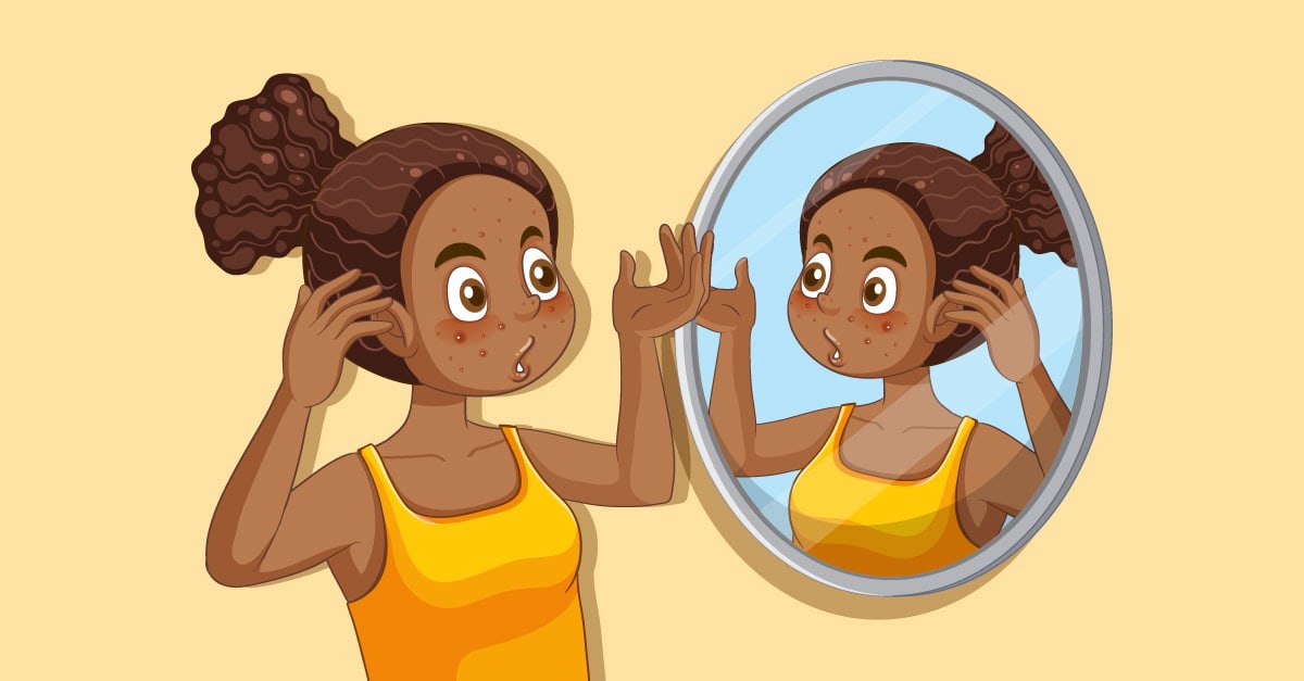 Acne as You Age Banner